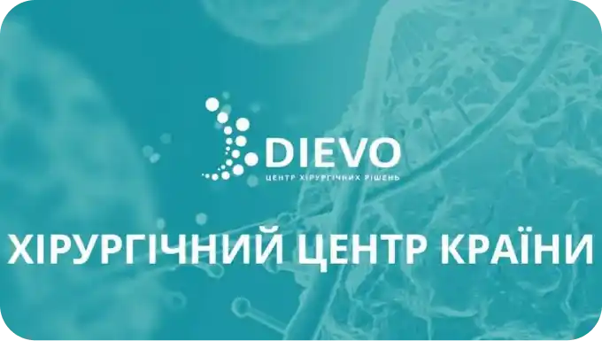 DIEVO